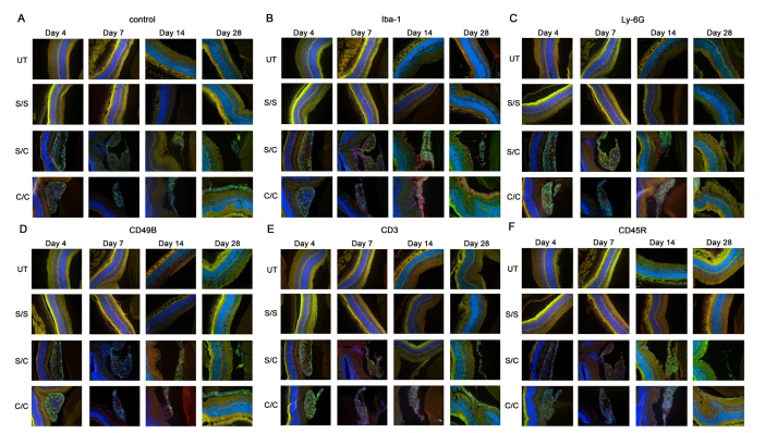 Figure 2. Immuno-labeling of infiltrated immune cells by treatment group. Immunofluorescent images of (A) control sections (secondary antibody alone), (B) anti-Iba-1 (activated macrophage and microglia marker), (C) anti-Ly-6G (neutrophil marker), (D) anti-CD49b (natural killer cell marker), (E) antibodies anti-CD3 (T cell marker), and (F) anti-CD45R (B cell marker) are displayed in the figure. The limited red signals present indicate positive antibody labeling for leucocyte markers, green signals indicate the gmRPC grafts and blue signals indicate DAPI nuclear labeling. Yellow is a nonspecific overlap of signals, most obvious in the photoreceptor outer segments which exhibit autofluorescence. Treatment groups: untreated (UT), both eyes untreated; S/S, both eyes sham-treated (sequentially) with vehicle; S/C, right eye injected with vehicle followed by left eye with 50,000 gmRPCs and; C/C, both eyes injected with 50,000 gmRPCs (sequentially) per schedule in Section 4
