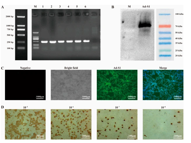 Figure 2. Identification of recombinant HAdV-C5–SARS-CoV-2 S1 protein and determination of adenovirus titer. (A) PCR detection of the recombinant plasmid with the target gene S1. (B) Western blot detection of SARS-CoV-2. Exponential-growth HEK293 cells were infected with SARS-CoV-2 for 48 h, then the cellular protein was extracted and separated by SDS-PAGE. SARS-CoV-2 expression was confirmed by Western blotting with goat anti-rabbit IgG. (C) Immunofluorescence microscopy of HEK-293 cells infected with Ad-S1 (green). Cells were counterstained with 40, 6-diamidino- 2-phenylindole (DAPI) to stain the nuclei. Scale bar 1000 µm. (D) Plaque assay was used for measurement. Micrographs depicting 10-5, 10-6, 10-7, and 10-8 dilution (from left to right).